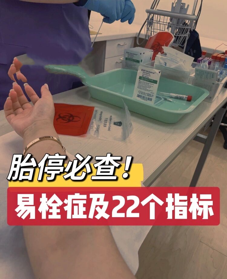 Fg和Fib区别 fpg和fbg的区别 